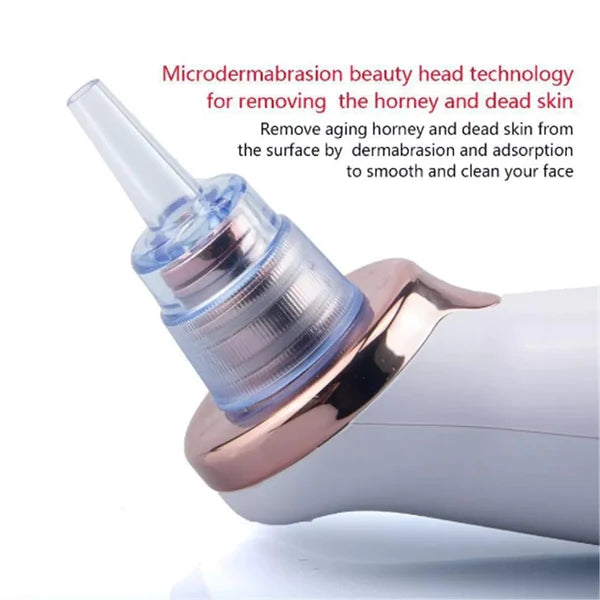 Microcrystalline Blackhead remover